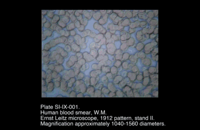 SI-IX-001.png – Human Blood Smear, W.M.
