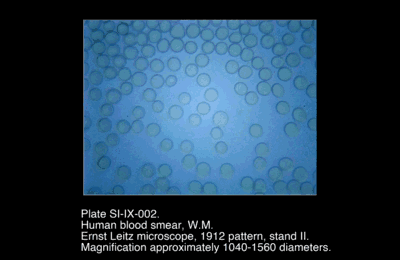 SI-IX-002.png – Human Blood Smear, W.M.