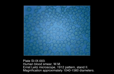 SI-IX-003.png – Human Blood Smear, W.M.