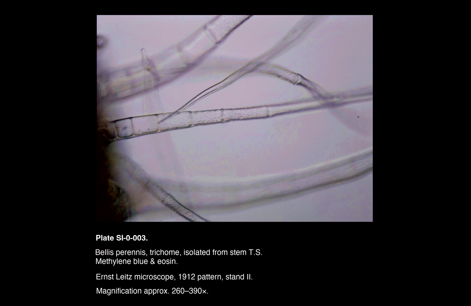 SI-0-003.png – Bellis perennis, trichome, isolated from stem T.S.