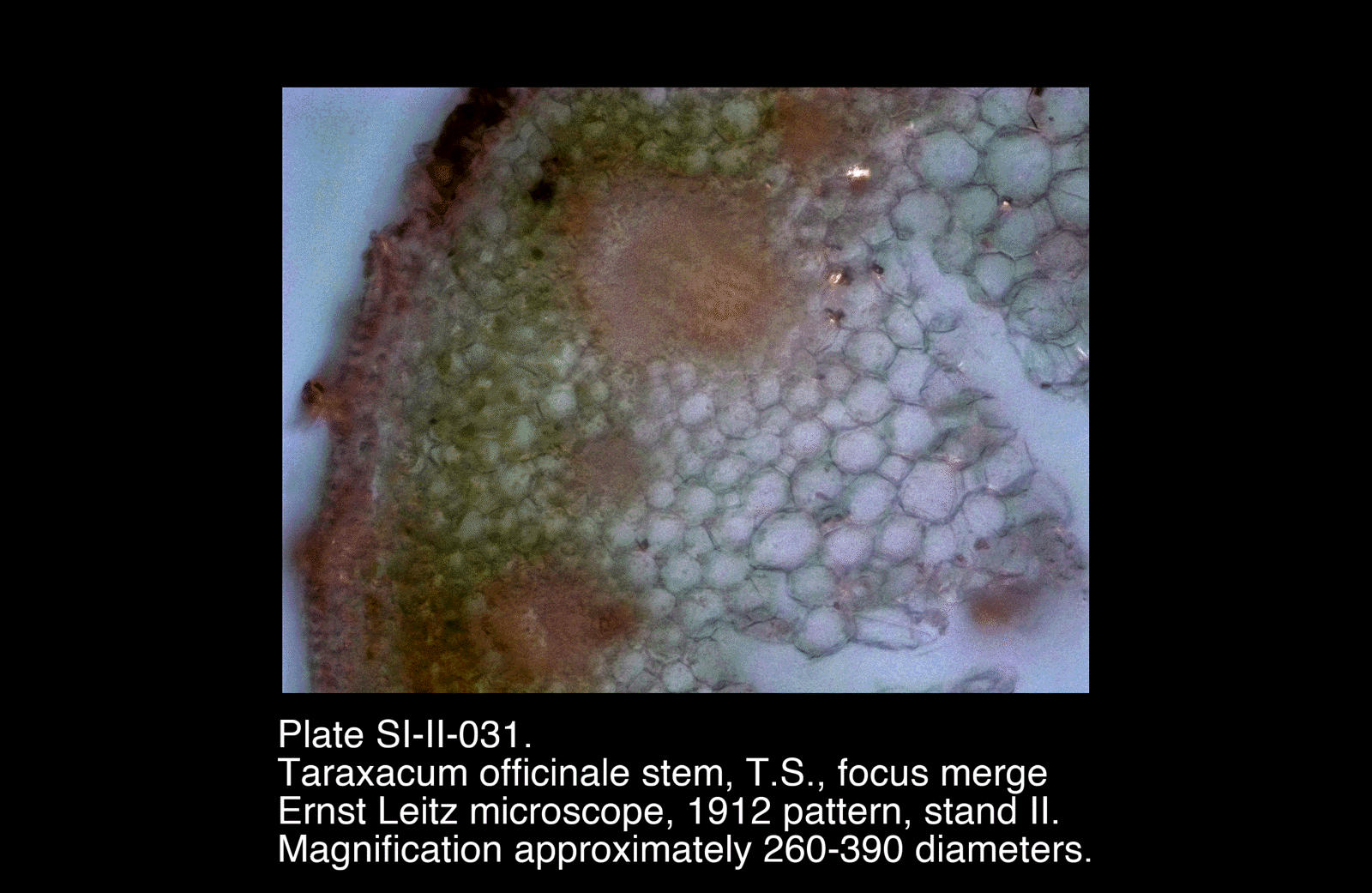 SI-II-031.png – Taraxacum officinale stem, T.S., focus merge