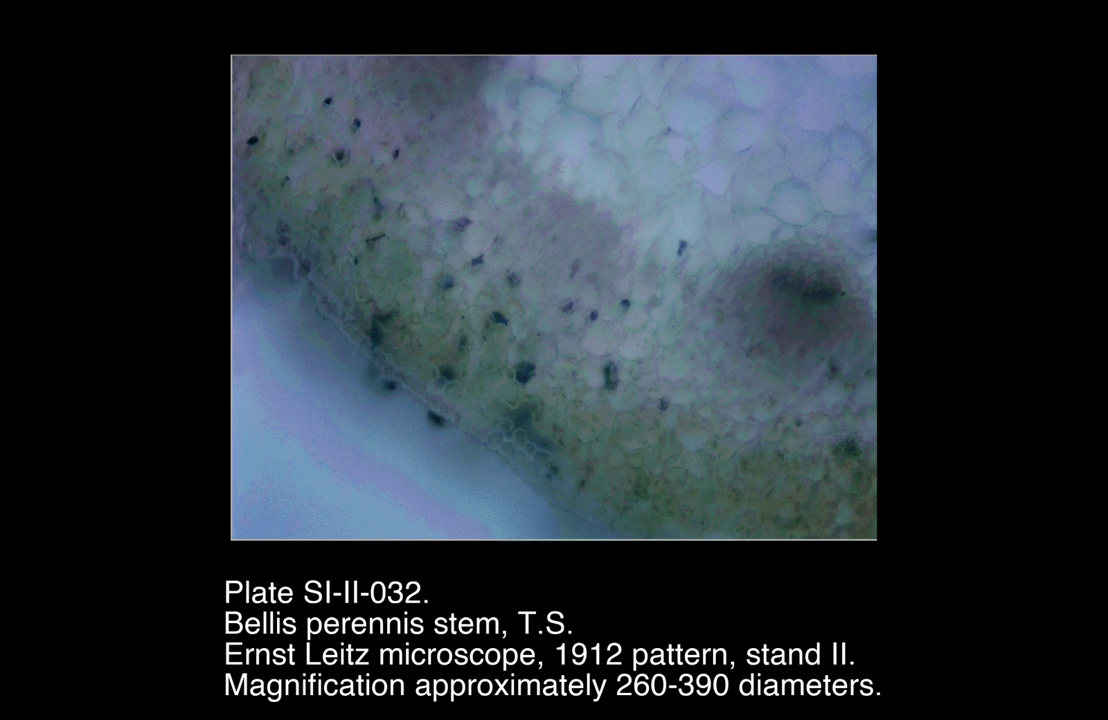 SI-II-032.png – Bellis perennis stem, T.S.