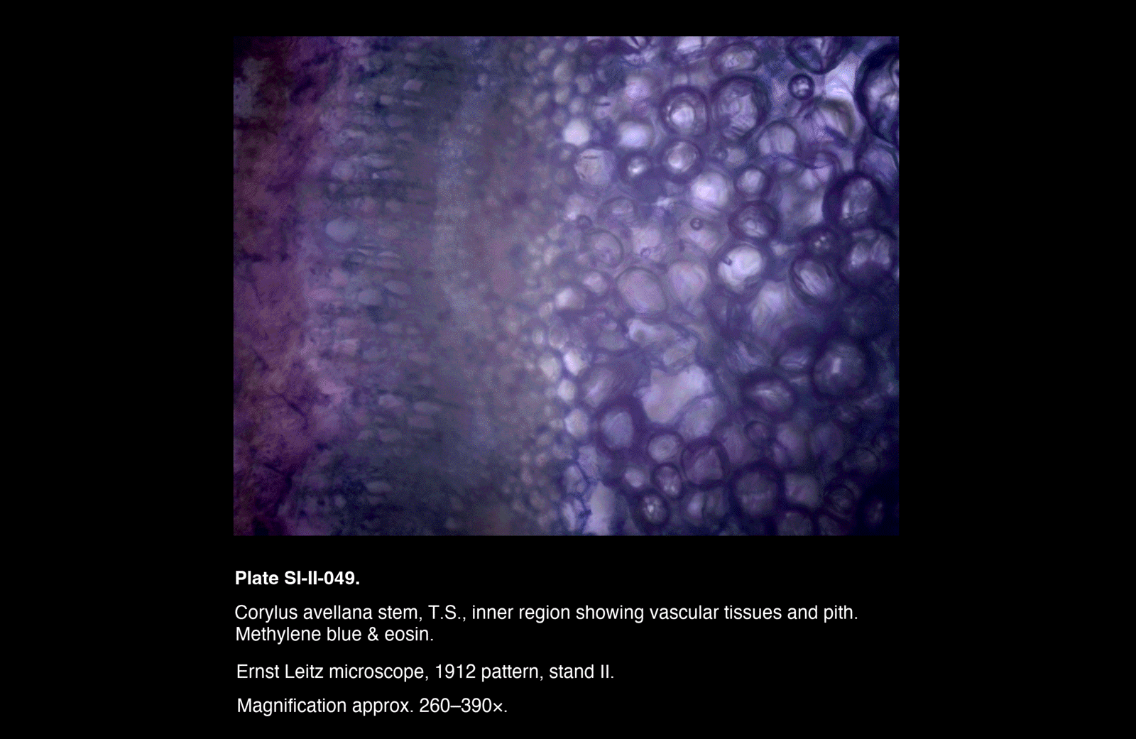 SI-II-049.png – Corylus avellana stem, T.S., inner region showing vascular tissues and pith.