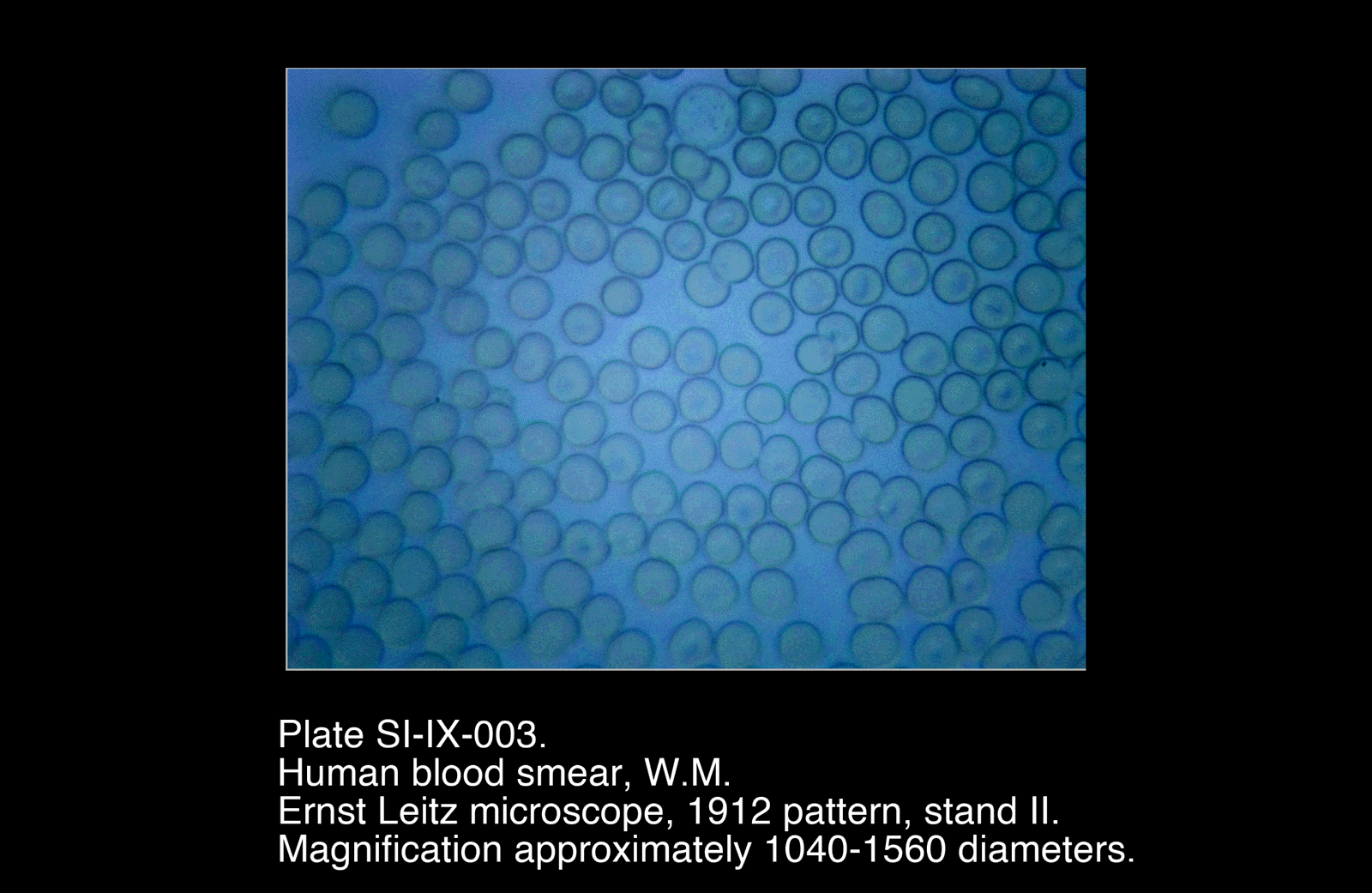 SI-IX-003.png – Human Blood Smear, W.M.