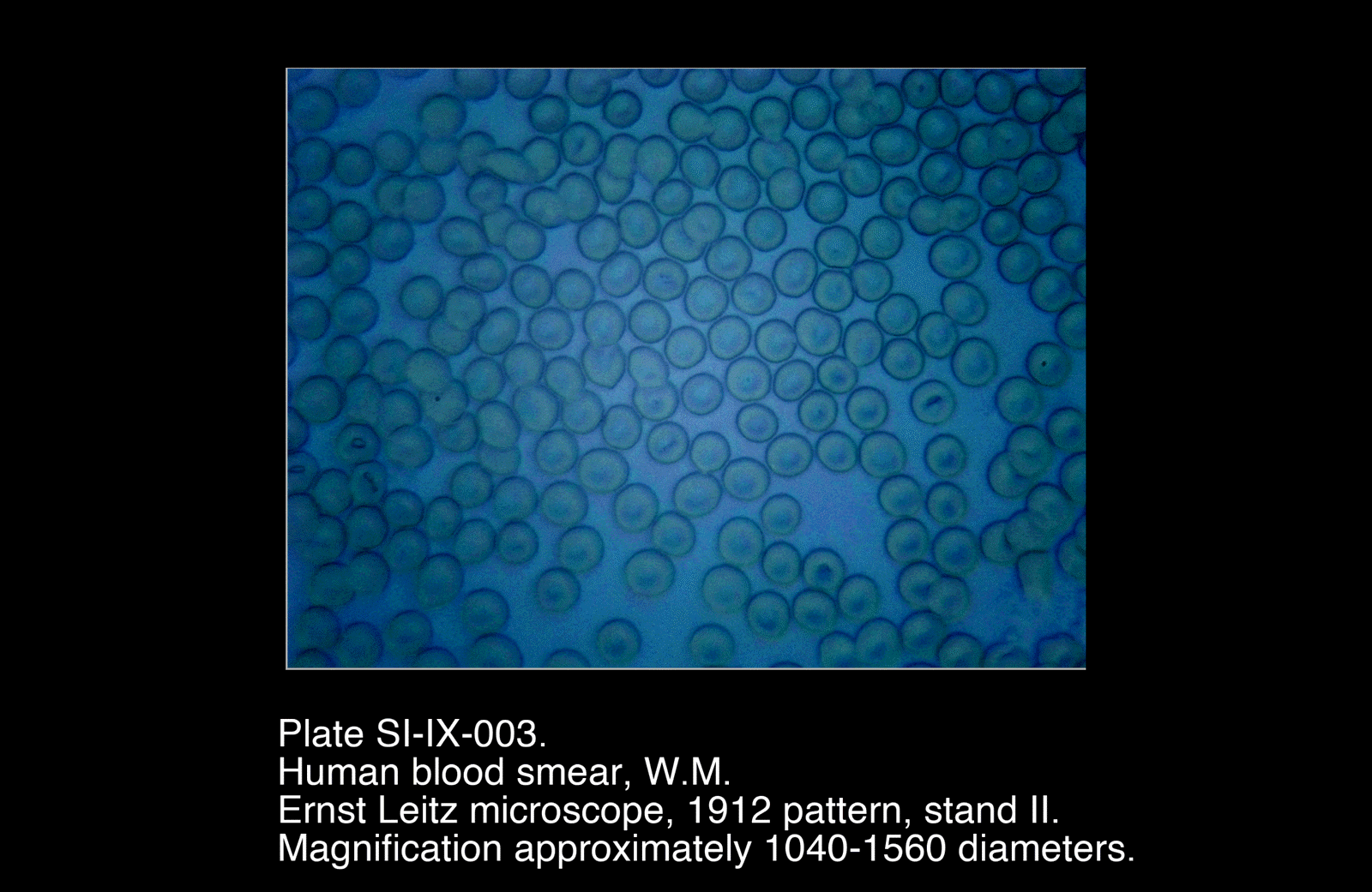 SI-IX-004.png – Human Blood Smear, W.M.