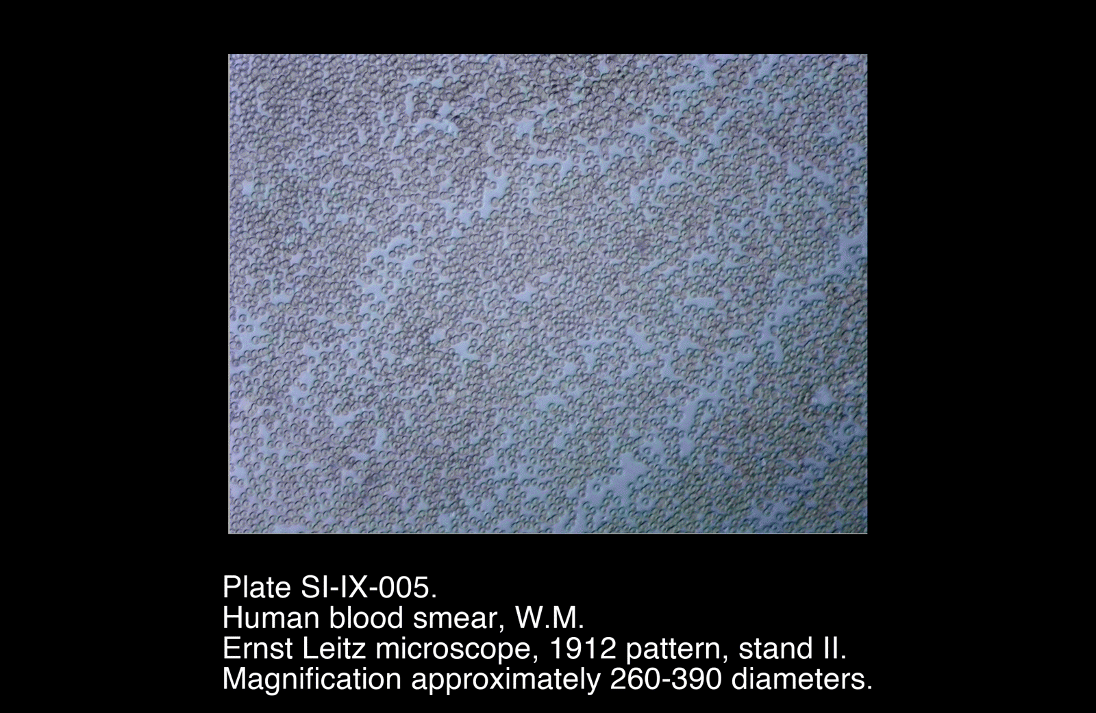 SI-IX-005.png – Human Blood Smear, W.M.